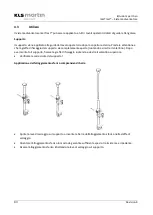 Preview for 80 page of KLS Martin 15-924-00-04 Instructions For Use Manual