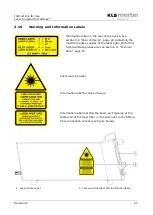 Preview for 21 page of KLS Martin diomax Instructions For Use Manual