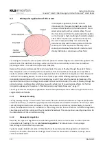 Preview for 14 page of KLS Martin maXium smart C Instructions For Use Manual