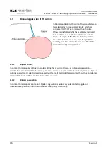 Preview for 16 page of KLS Martin maXium smart C Instructions For Use Manual