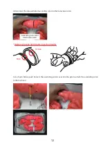 Preview for 13 page of KOKEN Colonoscopy Lower GI Endoscopy Simulator Type II Instruction Manual