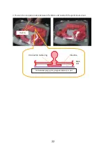 Preview for 23 page of KOKEN Colonoscopy Lower GI Endoscopy Simulator Type II Instruction Manual