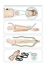 Preview for 3 page of laerdal IV Arm Installation Manual