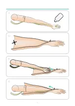 Preview for 6 page of laerdal IV Arm Installation Manual