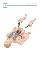 Preview for 10 page of laerdal SimMan Essential Bleeding Quick Setup Manual