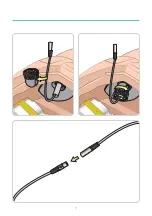 Preview for 11 page of laerdal SimMan Essential Bleeding Quick Setup Manual