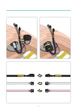 Preview for 13 page of laerdal SimMan Essential Bleeding Quick Setup Manual