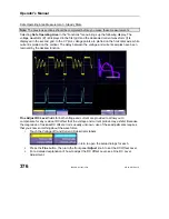 Предварительный просмотр 378 страницы LeCroy 6000 SERIES Operator'S Manual