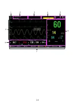 Предварительный просмотр 44 страницы Lepu Medical AIView 12V Operator'S Manual