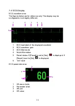 Preview for 87 page of Lepu Medical AIView 12V Operator'S Manual