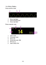 Предварительный просмотр 116 страницы Lepu Medical AIView 12V Operator'S Manual