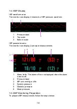 Предварительный просмотр 150 страницы Lepu Medical AIView 12V Operator'S Manual