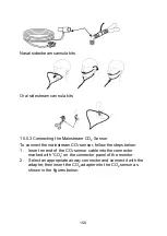 Предварительный просмотр 161 страницы Lepu Medical AIView 12V Operator'S Manual