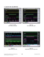 Preview for 78 page of LG CM9520 Service Manual