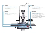 Preview for 3 page of Lightmed LIGHTLas SLT Deux-V Quick Start Manual