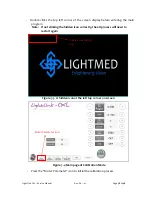 Preview for 59 page of Lightmed LightLink-CXL Service Manual