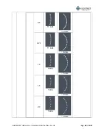 Предварительный просмотр 60 страницы Lightmed TruScan Pro Operator'S Manual