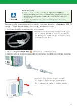 Предварительный просмотр 79 страницы LR Suprasorb CNP P3 Instructions For Use Manual