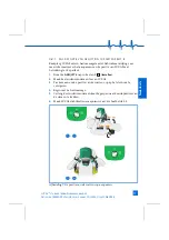 Preview for 41 page of LUCAS Stabilization Strap Instructions For Use Manual