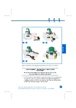 Preview for 61 page of LUCAS Stabilization Strap Instructions For Use Manual