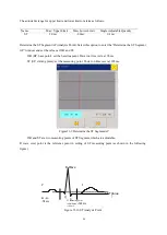 Предварительный просмотр 73 страницы Lutech Datalys V650 User Manual