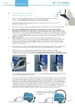 Preview for 6 page of MacroMedics DSPS-Prominent MR SAFE Instructions Manual