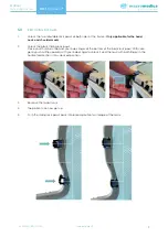 Preview for 9 page of MacroMedics DSPS-Prominent MR SAFE Instructions Manual