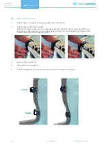 Preview for 9 page of MacroMedics DSPS-Prominent Instructions For Use Manual