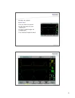 Preview for 13 page of Maquet SERVO-i User Manual