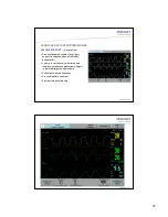 Preview for 28 page of Maquet SERVO-i User Manual