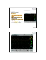 Preview for 34 page of Maquet SERVO-i User Manual