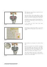 Preview for 16 page of Mathys balanSys REV Surgical Techniques