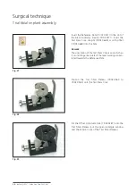 Preview for 20 page of Mathys balanSys REV Surgical Techniques