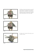 Preview for 33 page of Mathys balanSys REV Surgical Techniques