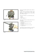 Preview for 35 page of Mathys balanSys REV Surgical Techniques