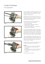 Preview for 37 page of Mathys balanSys REV Surgical Techniques