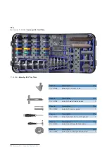 Preview for 82 page of Mathys balanSys REV Surgical Techniques