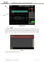 Preview for 23 page of MDMS ANI Monitor V2 User Manual