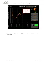 Preview for 25 page of MDMS ANI Monitor V2 User Manual