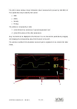 Предварительный просмотр 18 страницы Mdoloris ANI MOC-9 Instructions For Use Manual