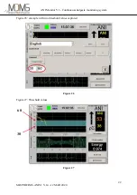 Предварительный просмотр 26 страницы Mdoloris ANI Monitor V1 User Manual