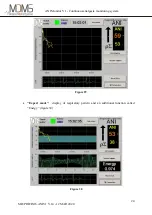 Предварительный просмотр 28 страницы Mdoloris ANI Monitor V1 User Manual