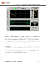 Предварительный просмотр 21 страницы Mdoloris ANI V1 User Manual