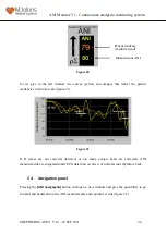 Предварительный просмотр 24 страницы Mdoloris ANI V1 User Manual