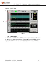 Предварительный просмотр 28 страницы Mdoloris ANI V1 User Manual