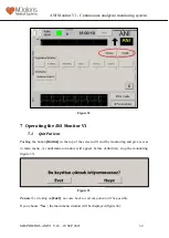 Предварительный просмотр 32 страницы Mdoloris ANI V1 User Manual