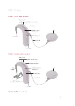 Предварительный просмотр 15 страницы MED-EL Me151 Series User Manual