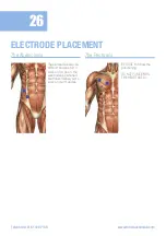 Preview for 26 page of Med-Fit Premier EMS Plus Patient Instruction & User Manual