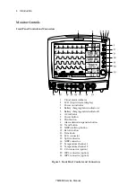 Предварительный просмотр 10 страницы Mediana YM6000 Service Manual