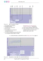 Предварительный просмотр 58 страницы Medical Technologies EasyOne Pro Operator'S Manual